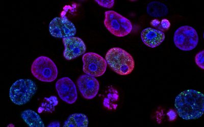 A Dijon, un nouveau microscope unique en France